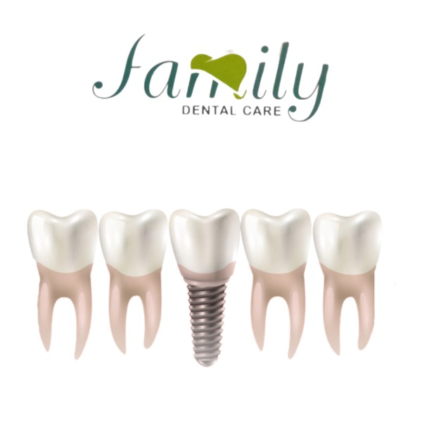 Root canal Treatment