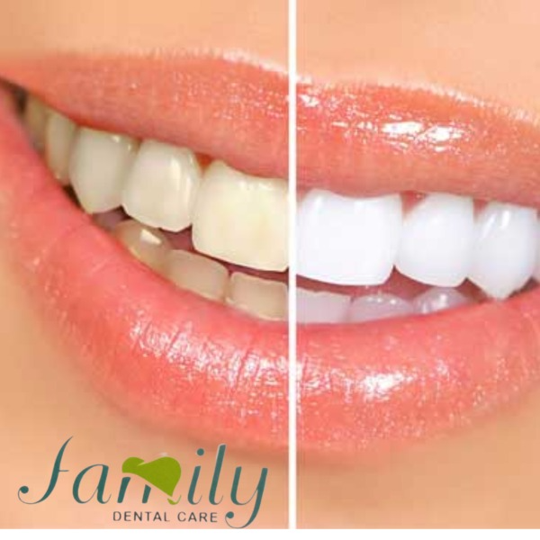 Cosmetic Dentistry