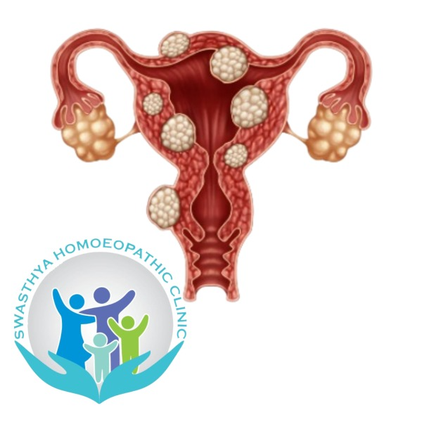 Menstrual disorders / Uterine tumors