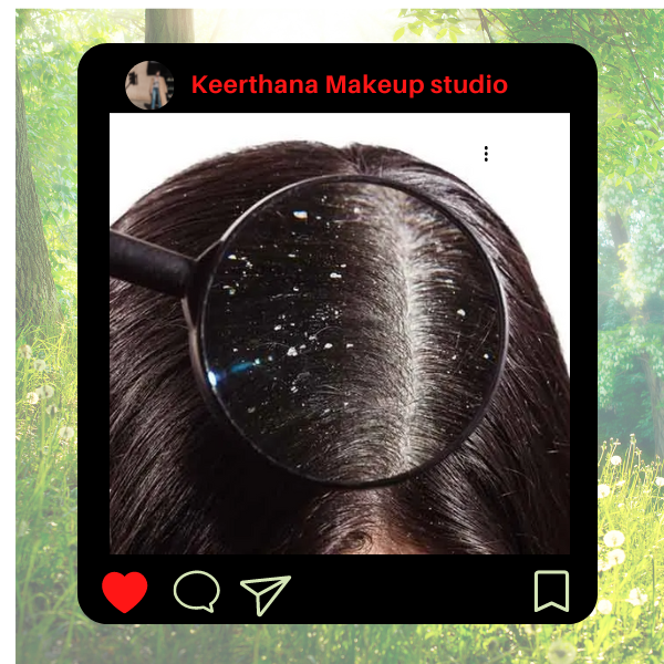 Drandruff & Hair Loss Treatment