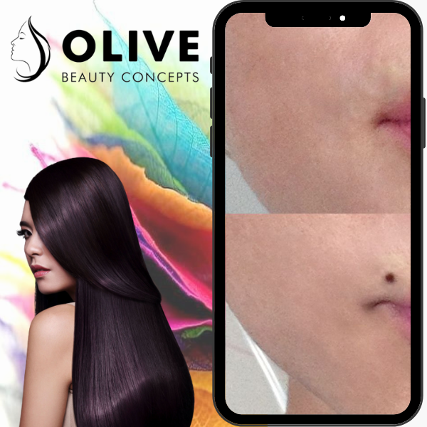 Permanent Beauty Spot