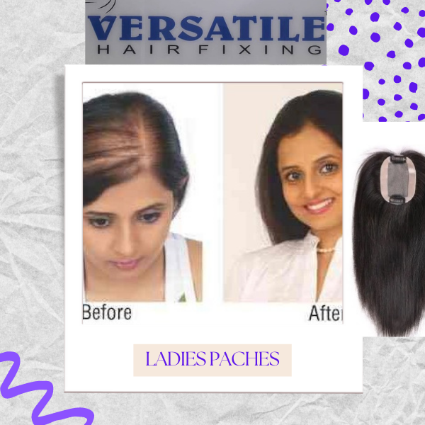 VERSATILE HAIR FIXING Comprehensive Solutions for All Hair Types Transform Your Look at Our Hair Fixing Versatile Hair Fixing Customized Solutions for Every Hair Concern Discover the