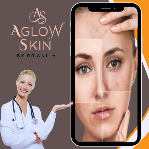 Skin Allergy