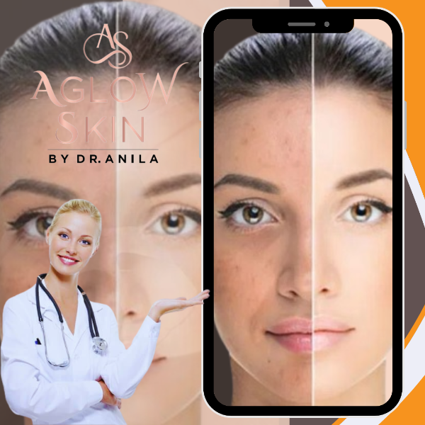 Pigmentation