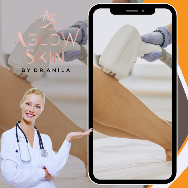Laser Hair Removal