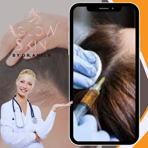 PRP for face & hair re growth