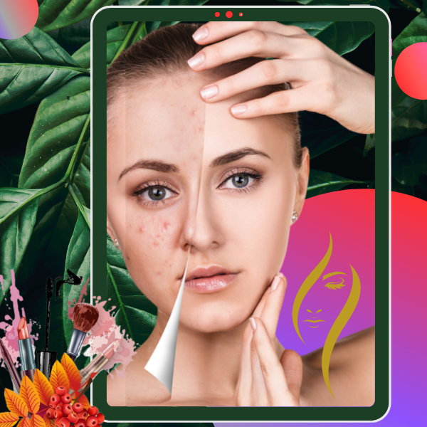 Pimple Treatment