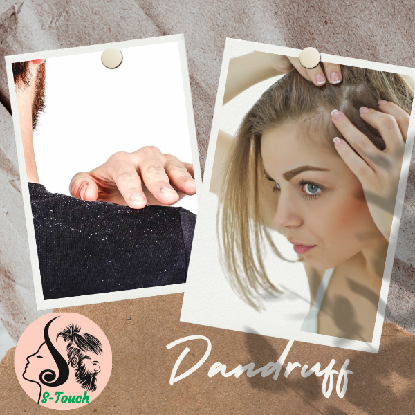 Dandruff & Hair Loss Treatment