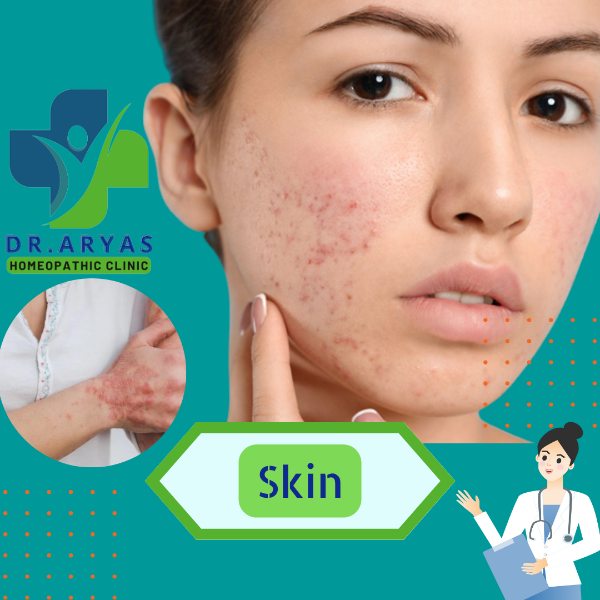 Skin Disease