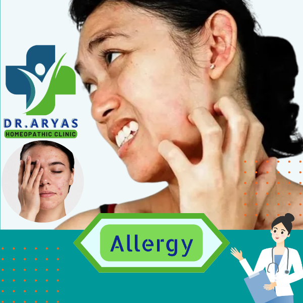 Allergy
