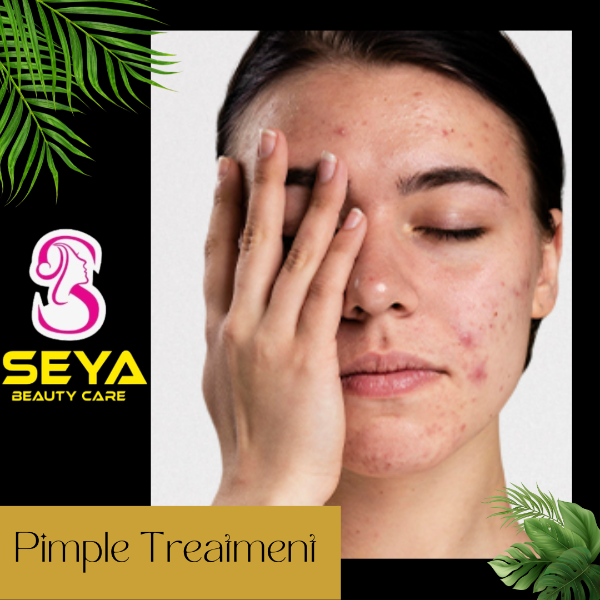 Pimple Treatment