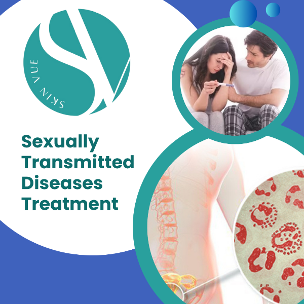Sexually Transmitted Diseases Treatment