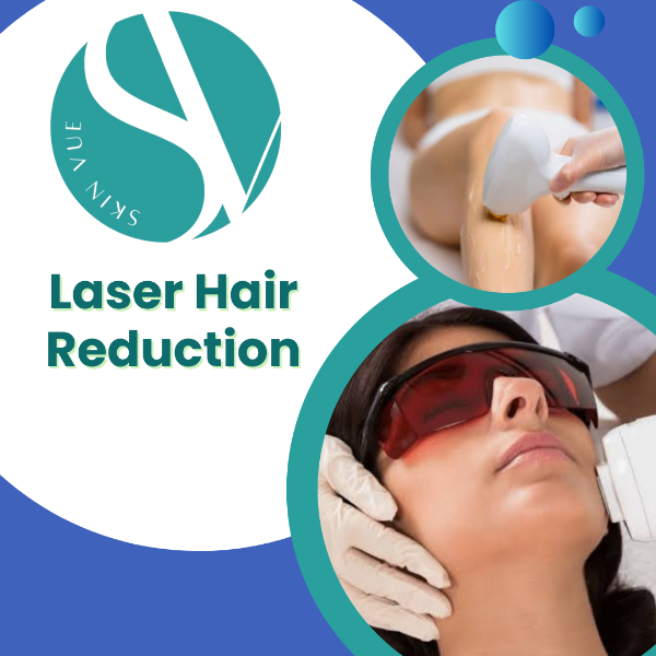 Laser Hair Reduction