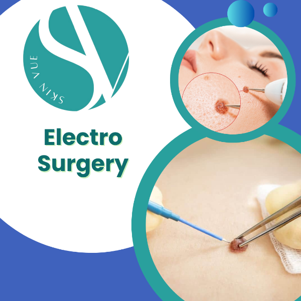 Electro Surgery