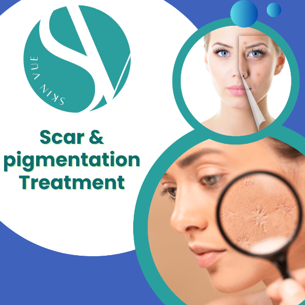 Scar & Pigmentation Treatment