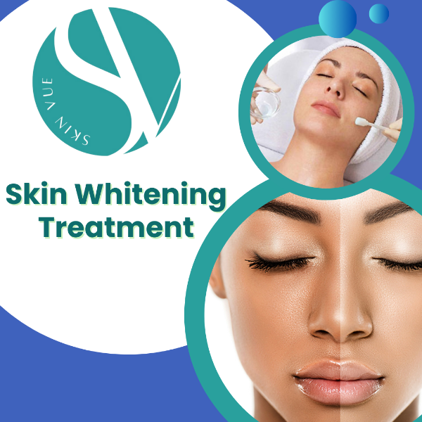 Skin Whitening Treatment