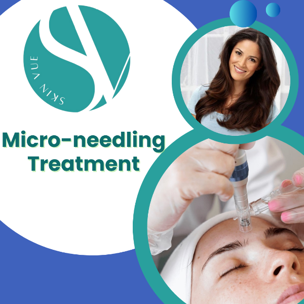 Micro needling Treatment