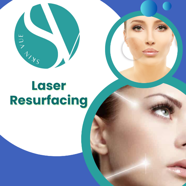 Laser Resurfacing