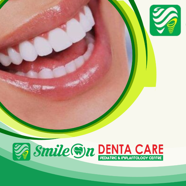 Cleaning and polishing