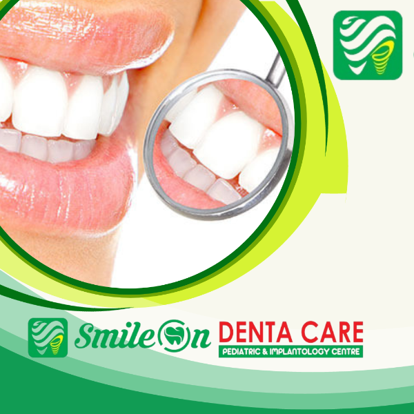 Teeth whitening/Bleaching