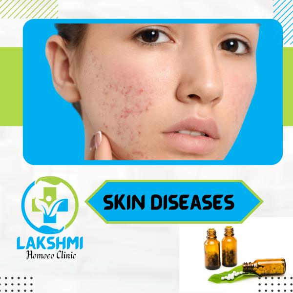 Skin Disease