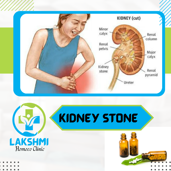 Kidney Stone