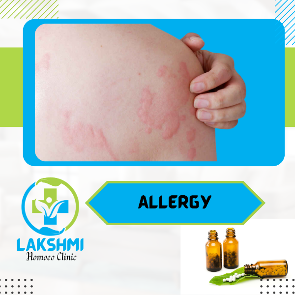 Allergy