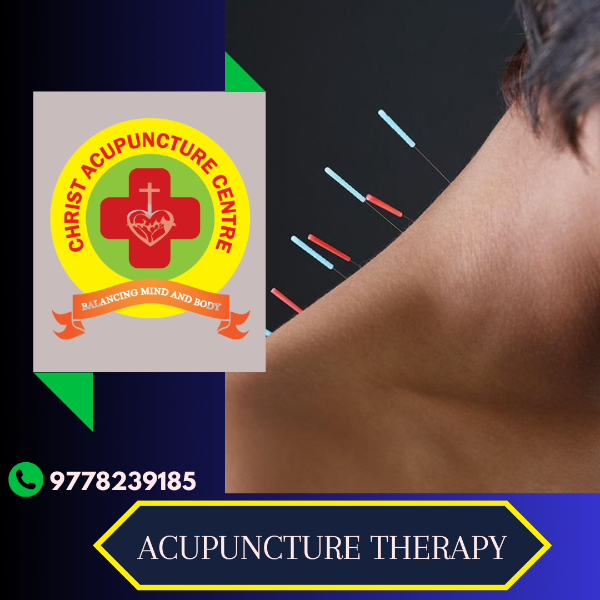 Acupuncture Therapy