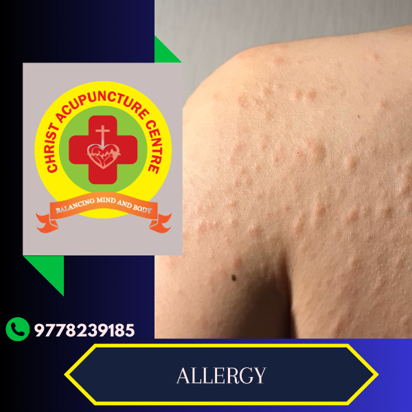 ALLERGY
