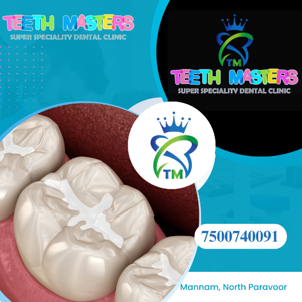 Fillings and sealants