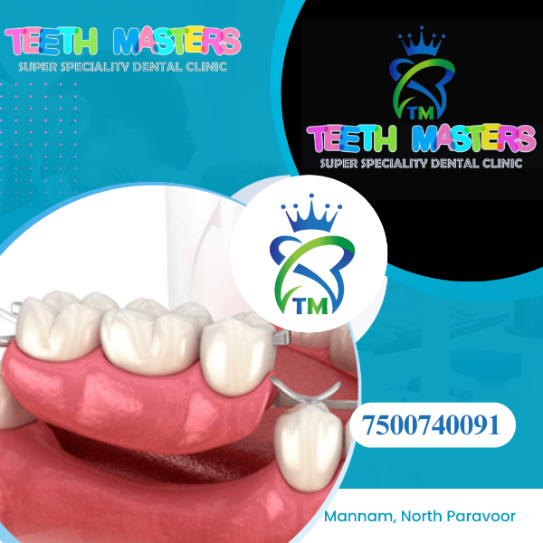 Bridges and Partial Dentures