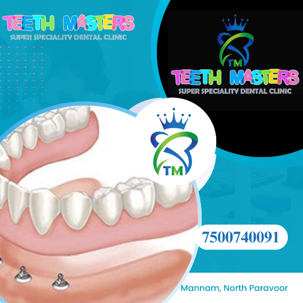 Full Dentures