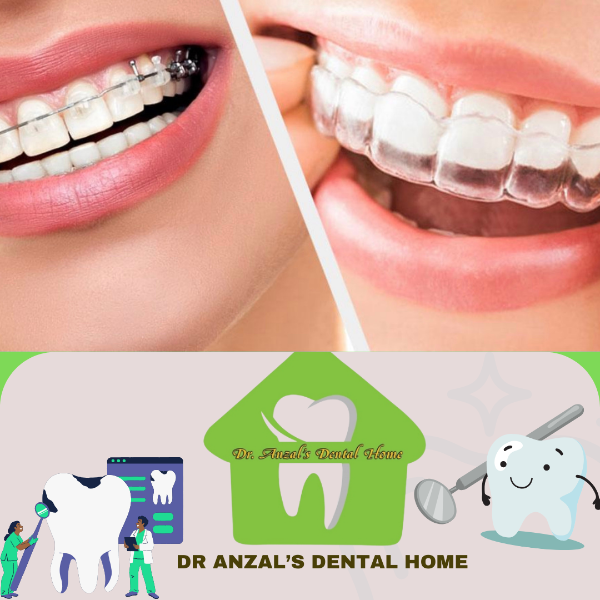 Orthodontic Treatment