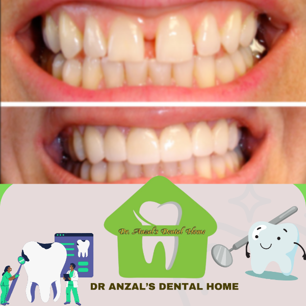 Cosmetic Dentistry