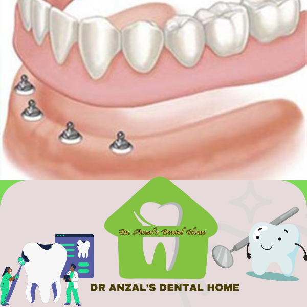 Prosthodontic Treatment