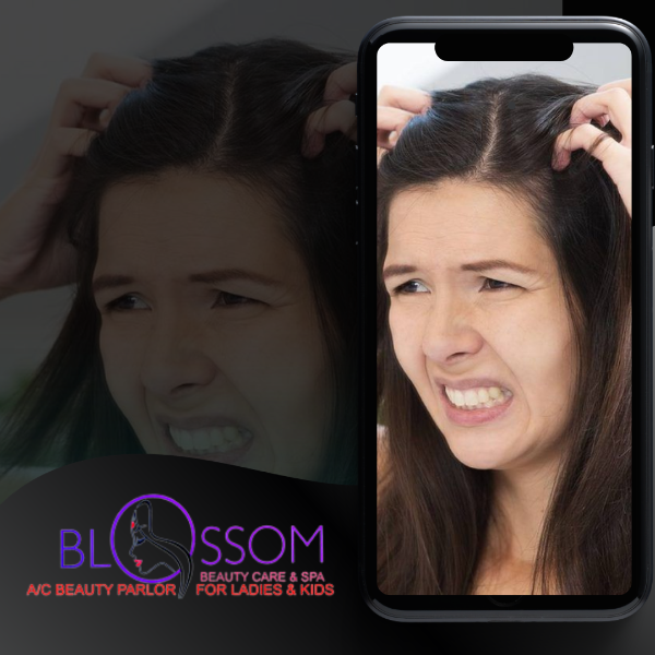 Hair Loss and Dandruff Treatment