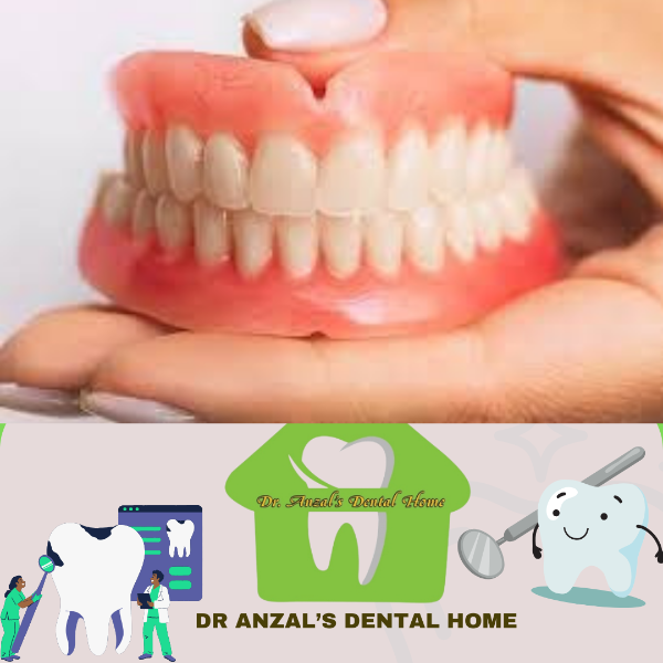 Full Dentures