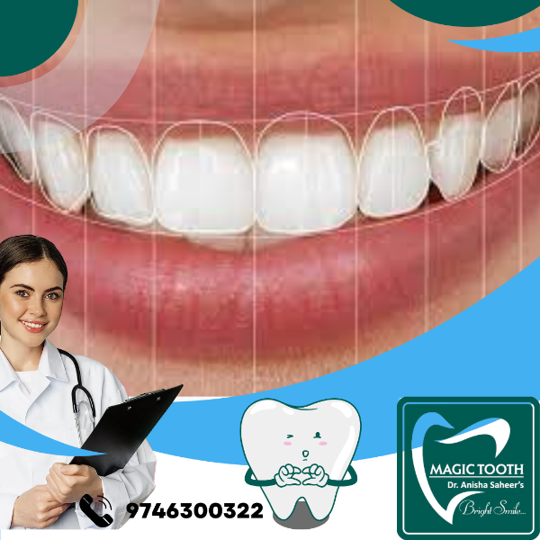 Smile Designing