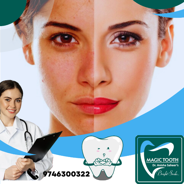 Super Facial, Medium & Deep peel