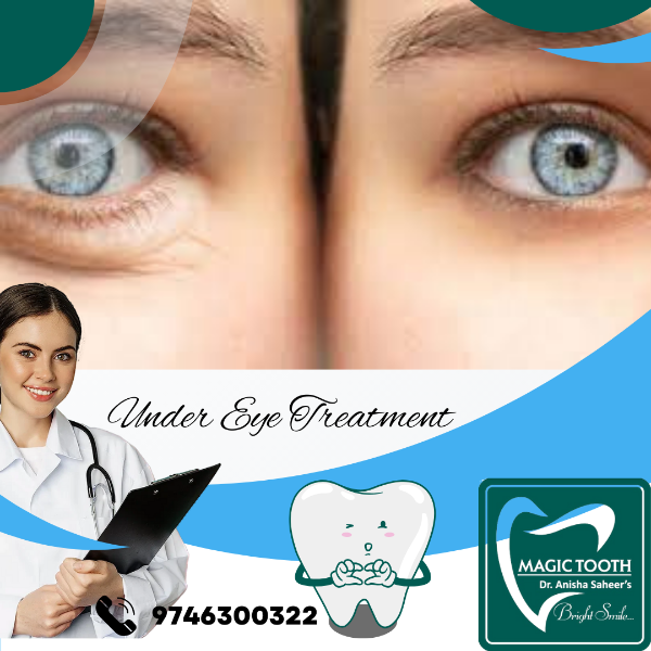 Under Eye Treatment
