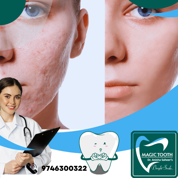 Scar Removal