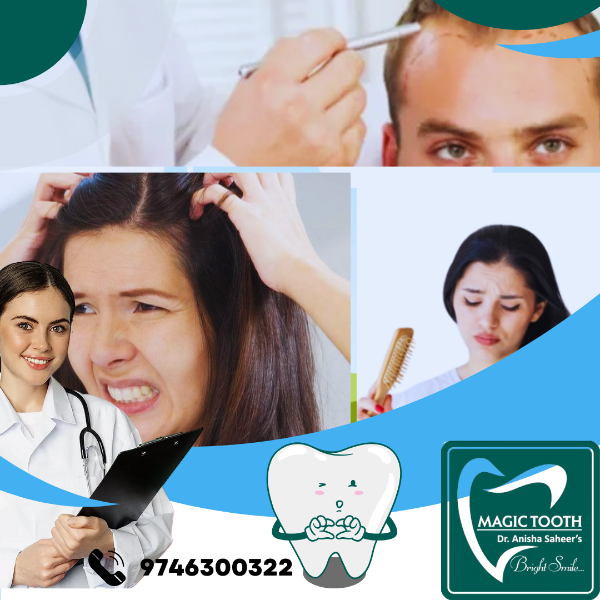 Anti Dandruff Treatment / Hair Loss : PRP, GRAFTING, HAIR FIXING