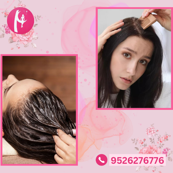 DANDRUFF TREATMENT