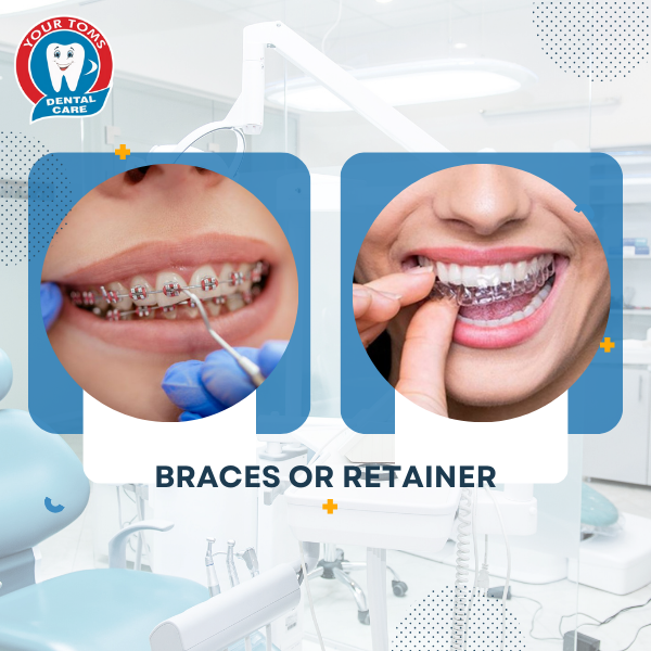 BRACES OR RETAINER