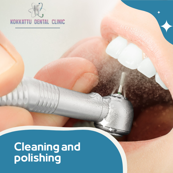 Cleaning and Polishing