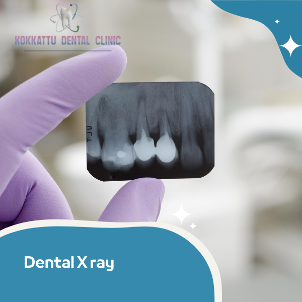 Dental X ray