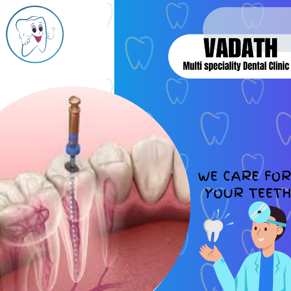 Root canal Treatment