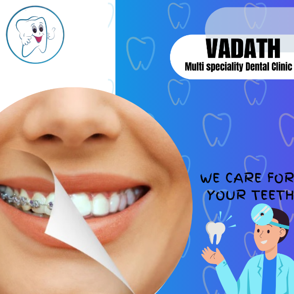 Orthodontic treatment- steel & ceramic braces,clear aligner