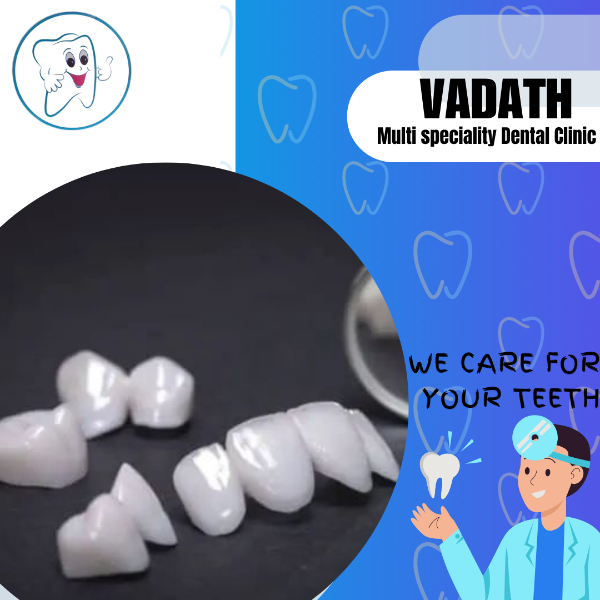 Veneers and Crown