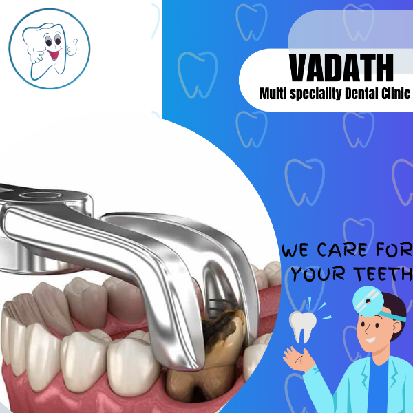 Dental extraction
